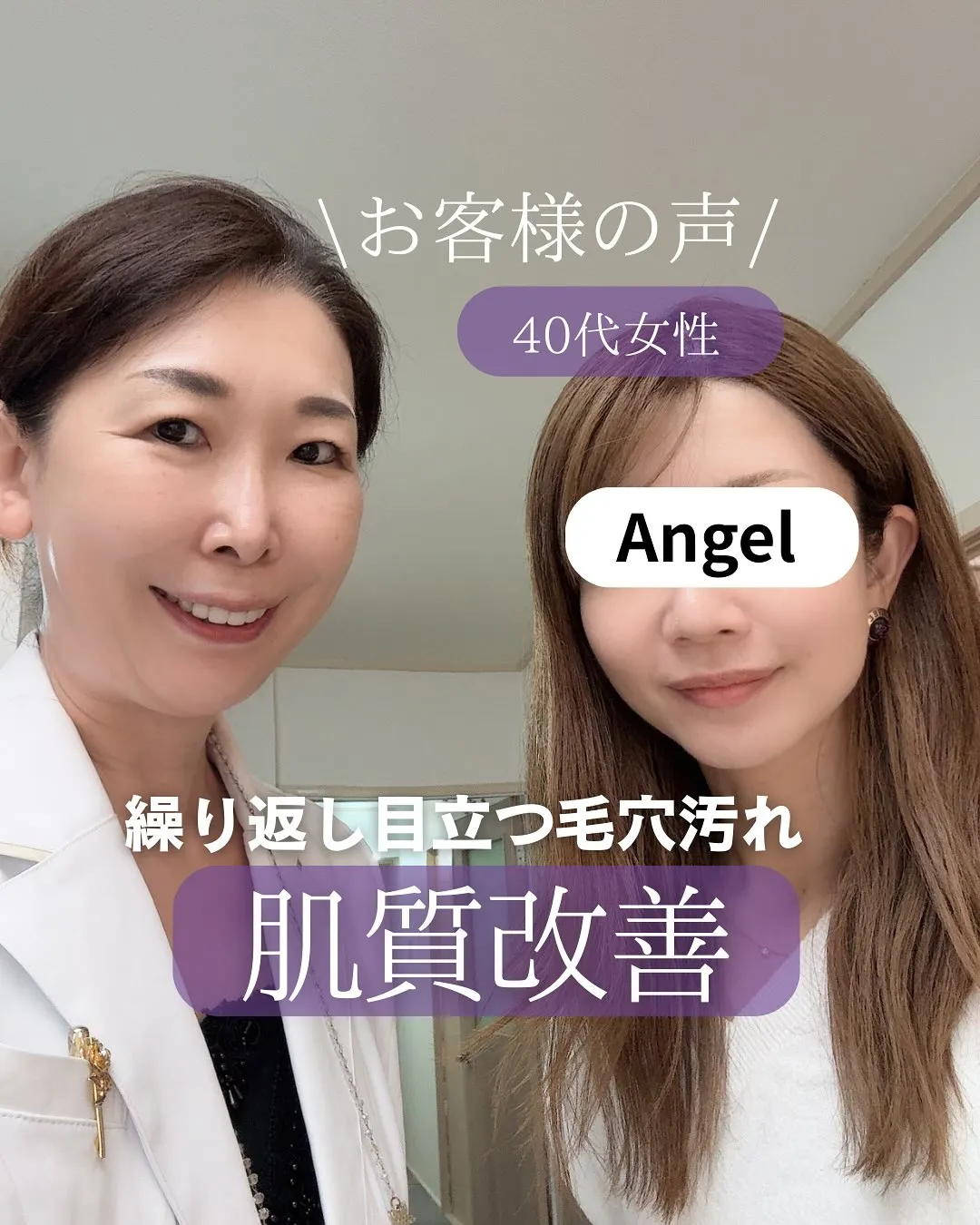 仙台フェイシャル 毛穴ケア